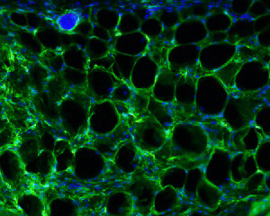  Fluorescent microscopic image of fibrotic scars in fat tissue. In this image, the fat cells are not labeled and appear as black holes surrounded by green collagen (the main component of scar tissue). Cell nuclei are blue. Image provided by Oklahoma Medical Research Foundation scientist Lorin Olson, Ph.D. 